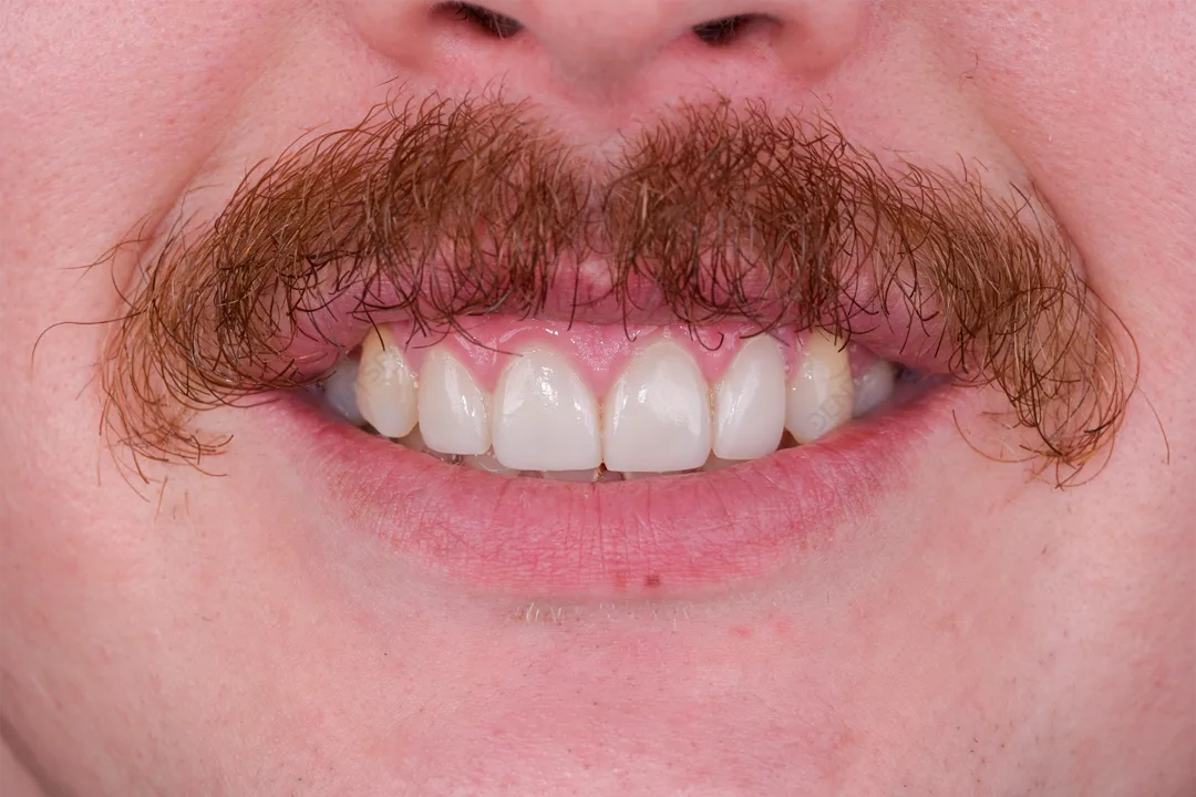 Before Image