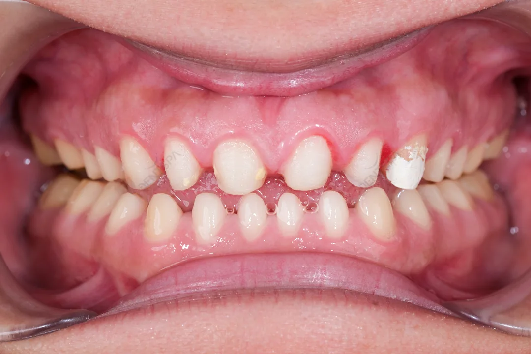 Before Image