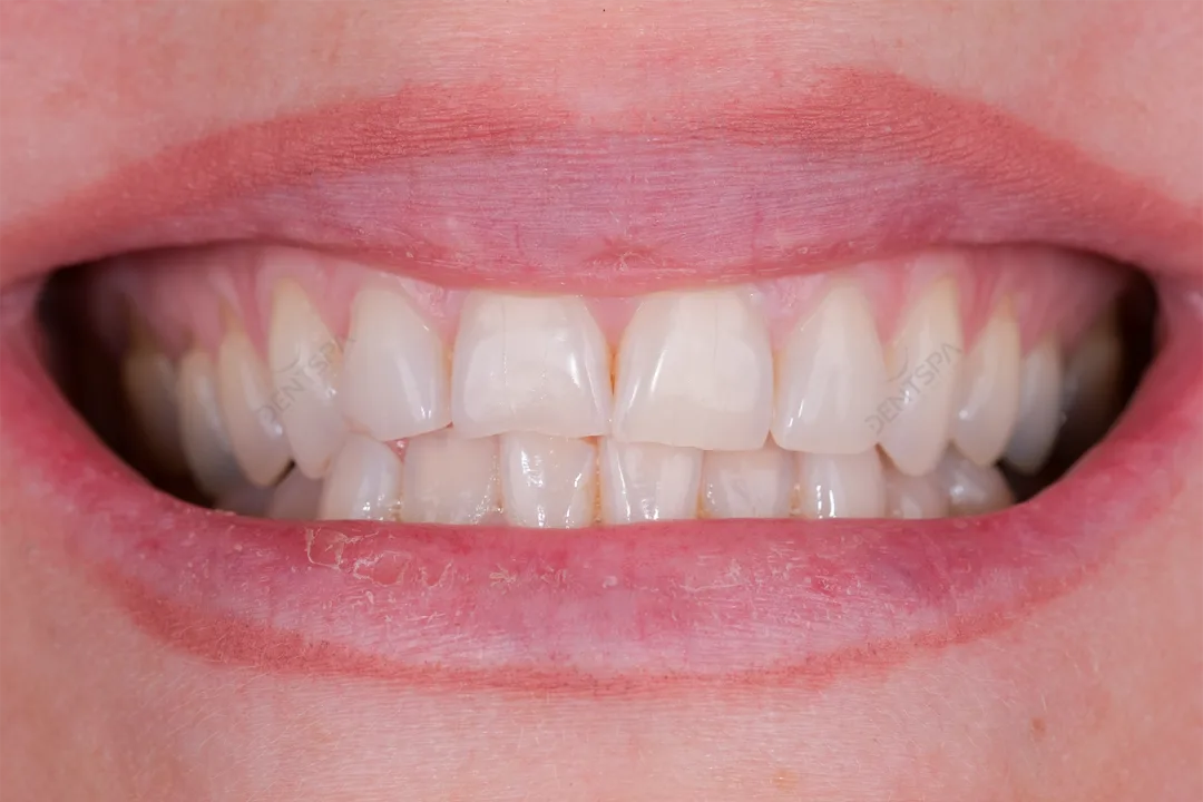 Before Image