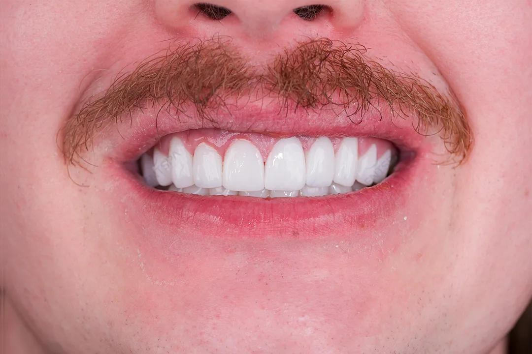 After Image