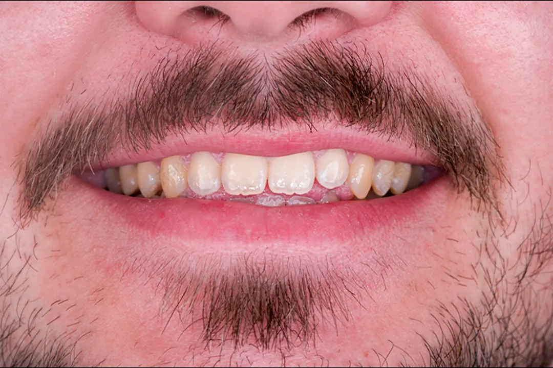 Before Image