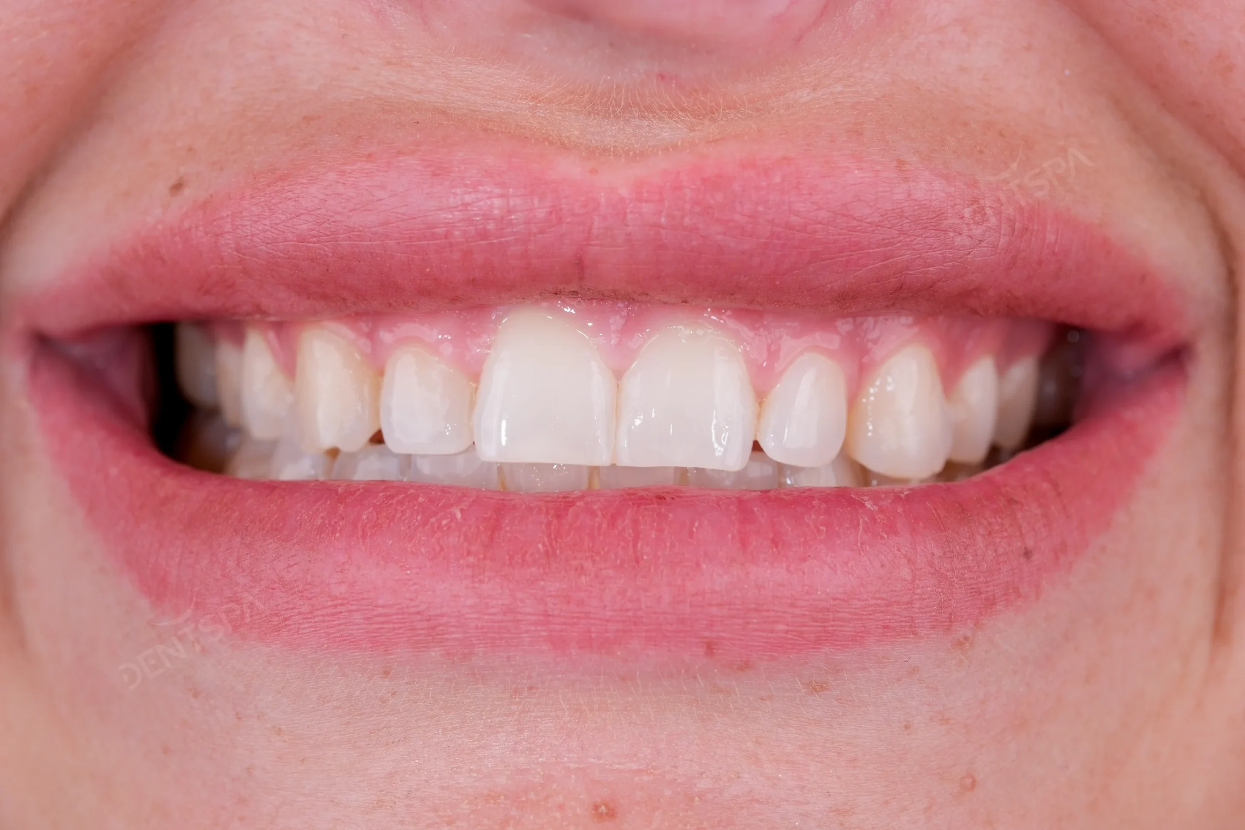 Before Image
